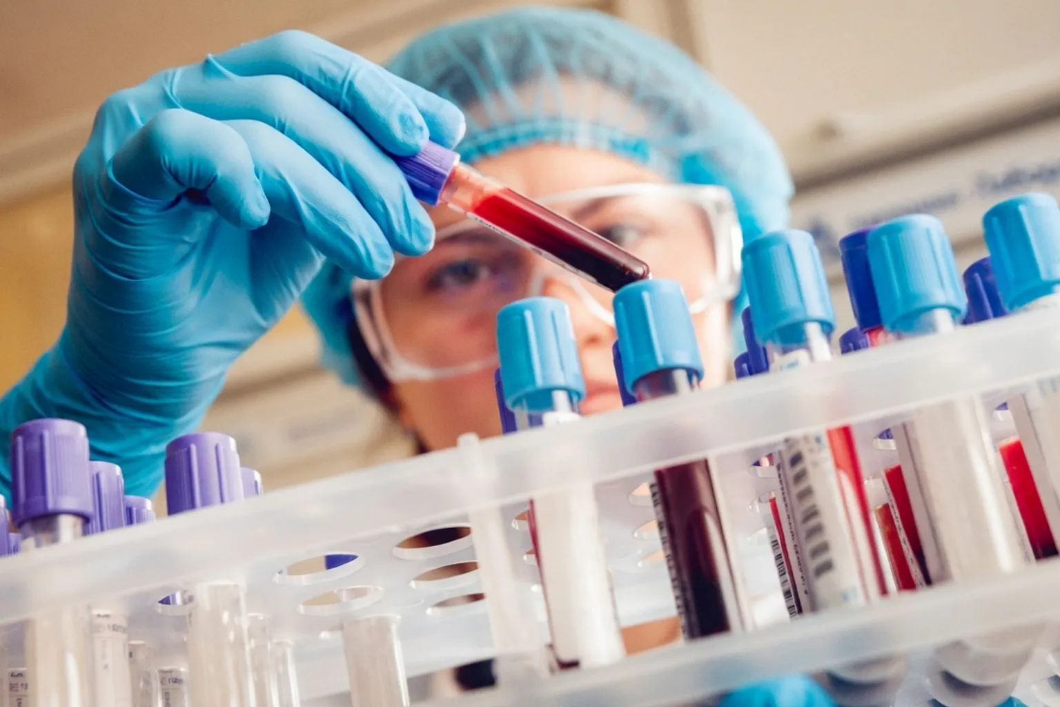 Анализ крови на ctDNA как способ раннего выявления рецидива рака молочной железы