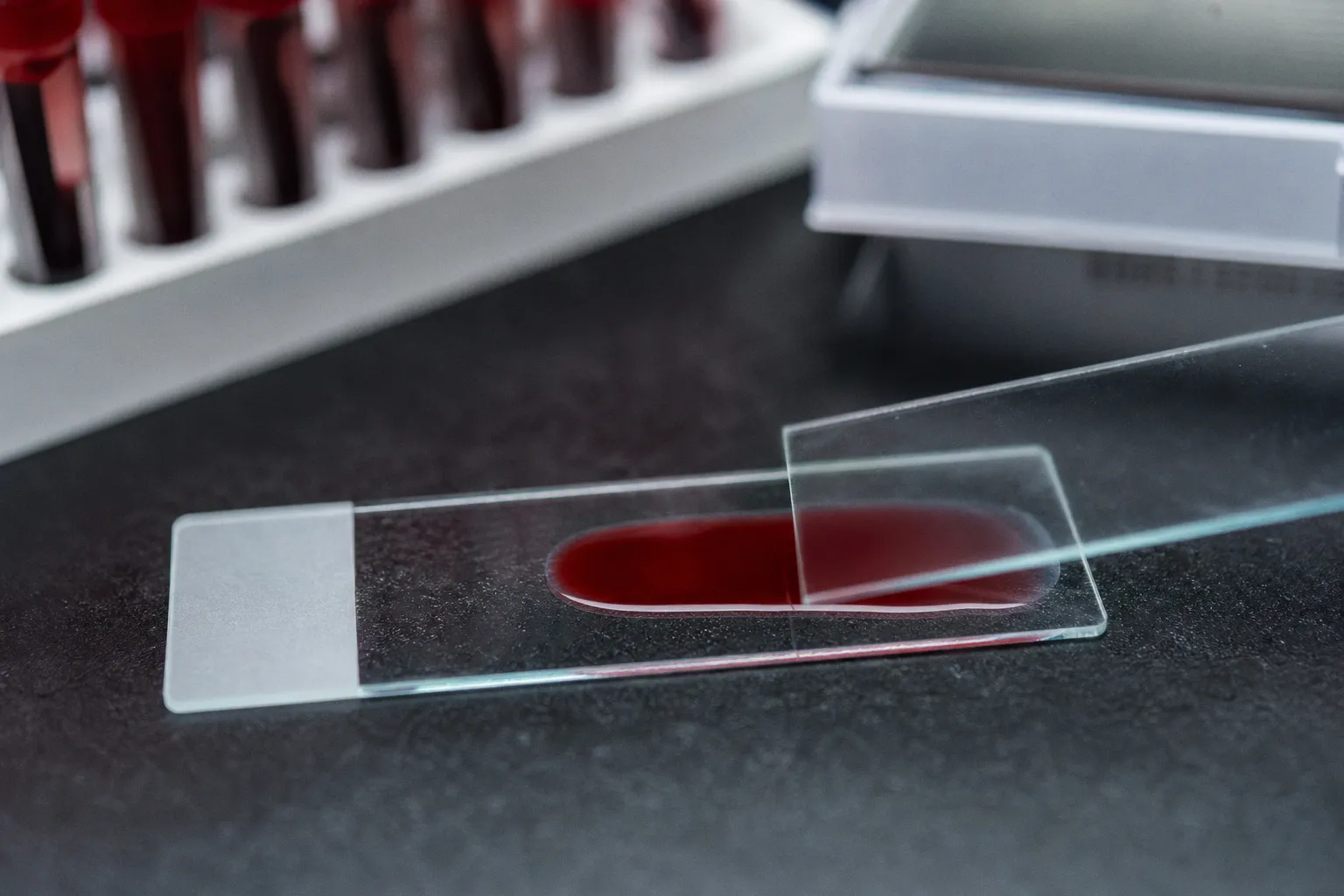 Инновационный анализ крови на обломки ДНК заменяет классическое УЗИ в диагностике рака печени